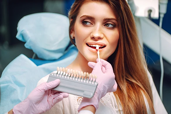 What Are Dental Veneers?