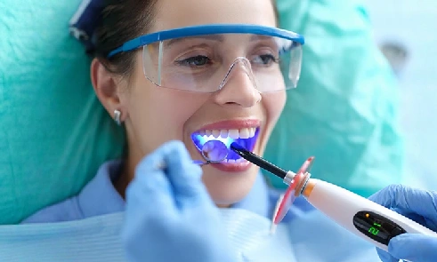 Dental Bonding